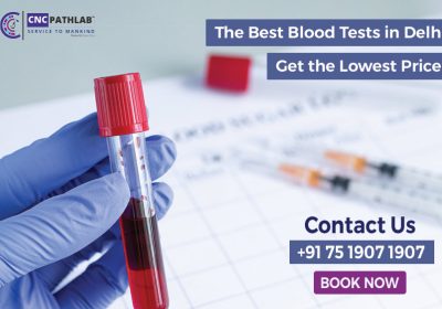best-blood-test-in-delhi